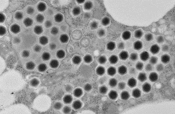 新種の巨大ウイルス「ウシクウイルス」を茨城県牛久沼から発見 ～ユニークなカプシド構造をもち、宿主細胞を肥大化させる新ウイルス、真核生物の進化の謎を解く鍵に～