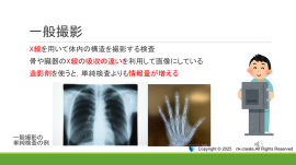 動画例1 動画例1