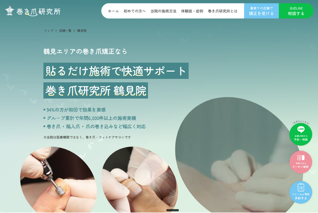 巻き爪研究所、症状別に選べる店舗ページを公開