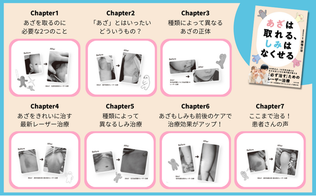 『あざは取れる、しみはなくせる』刊行 ― レーザー治療専門医が臨床経験をまとめた新著を刊行