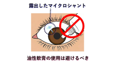 【名古屋大学】緑内障インプラント（マイクロシャント）の術後管理に新知見 ～マイクロシャント露出時は油性眼軟膏の使用を避けるべき～