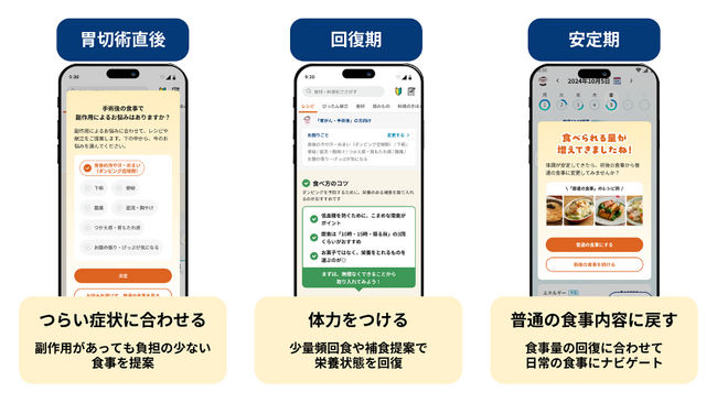 ヘルスケアスタートアップ「おいしい健康」デジタルヘルスを用いた胃がん切除術患者の伴走支援に関する共同臨床研究を京都府立医科大学消化器外科と開始