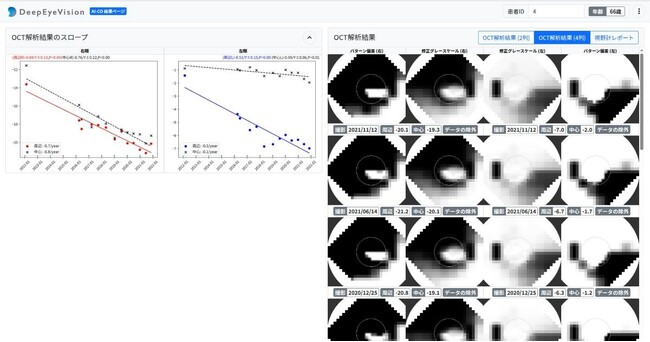 自治医科大学発ベンチャー・DeepEyeVision、緑内障診療等の効率化を目指した新しい医療機器プログラムを全国で販売開始 ～自動視野・眼撮影装置(OCT)用プログラム AI-CO（アイコ）～