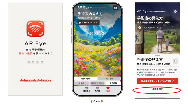 白内障の症状・手術後の見え方を疑似体験できる医師監修の無料アプリ「AR Eye」多焦点眼内レンズの種類を選択できるバージョンアップ版提供開始
