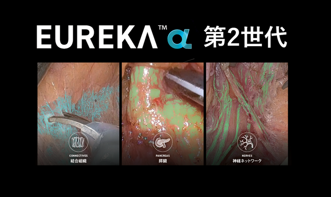 手術認識支援AI「EUREKA α」機能追加・適応拡大に伴う薬事承認を取得し、臨床現場で「判断を支える」フェーズへ