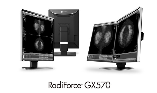 EIZO、高性能と環境配慮を両立する5メガピクセル対応の医用モノクロモニターを発売