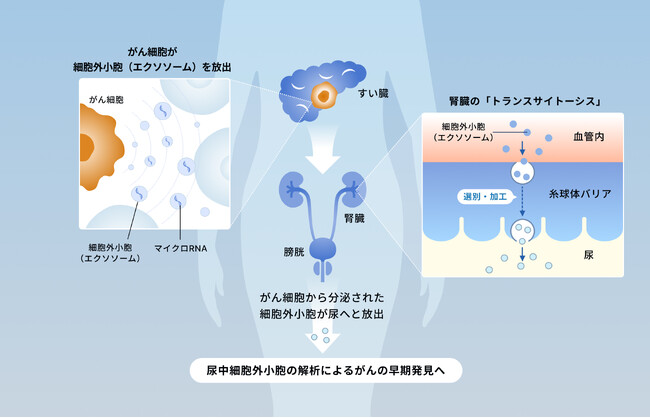 がんのサインは、血液よりも「尿」へ。その仕組みを世界で初めて解明