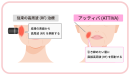 従来の高周波とATTIVA(アッティバ)の違い