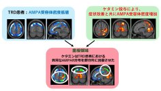 【横浜市立大学】ケタミンがうつ症状を改善する仕組みを解明