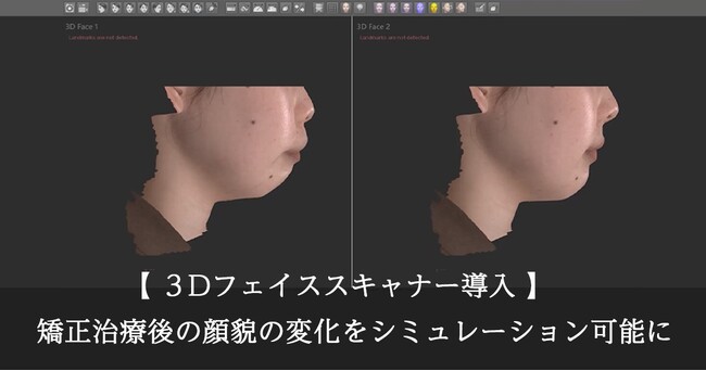 松山市の大谷歯科矯正歯科、3Dフェイススキャナー「MORPHEUS3D SCANNER」を導入。矯正治療後の顔貌変化をリアルな３次元シミュレーションで可視化