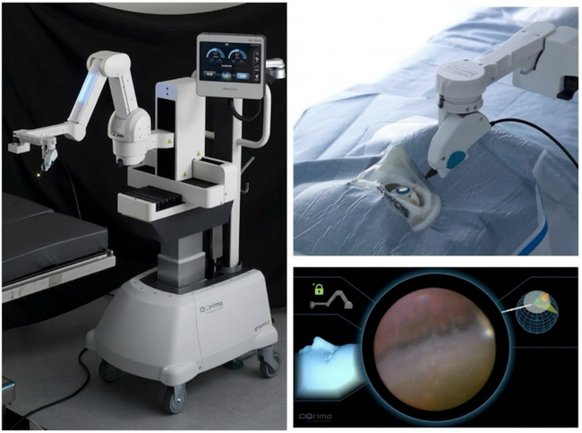 眼内内視鏡保持ロボット「OQrimo」による強膜圧迫を行わない周辺部網膜観察に成功