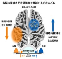 【昭和医科大学】左脳の脳腫瘍による言語障害の個人差を解明 ― 右半球の「構造的複雑さ」が言語処理速度を維持する予備能として機能する可能性を示唆 ―