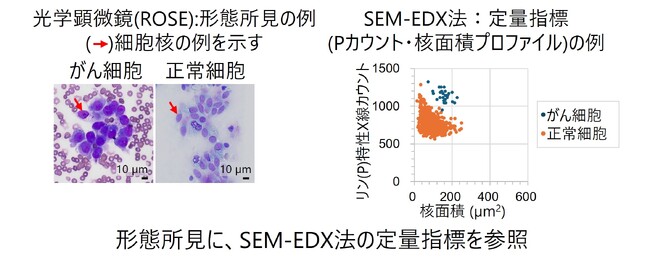 肺がん検査支援に向けて、走査電子顕微鏡観察とエネルギー分散型X線分光法による細胞解析技術を開発
