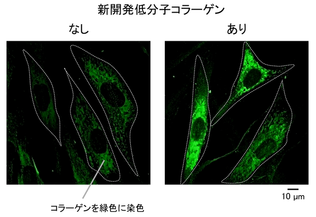 肌・骨・関節のコラーゲン産生を高める低分子コラーゲンを開発！ ～グリシルプロリン高含有で、コラーゲン合成の司令塔に働きかける～