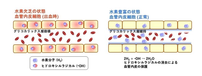 水素豊富生理食塩水が出血性ショックの血管内皮を保護し生存率を改善｜MiZ・大阪公立大学 共同研究