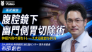 腹腔鏡下幽門側胃切除術 腹腔鏡下幽門側胃切除術