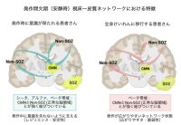 【横浜市立大学】てんかん発作時の意識障害に関わる視床-皮質ネットワークの特徴を発見