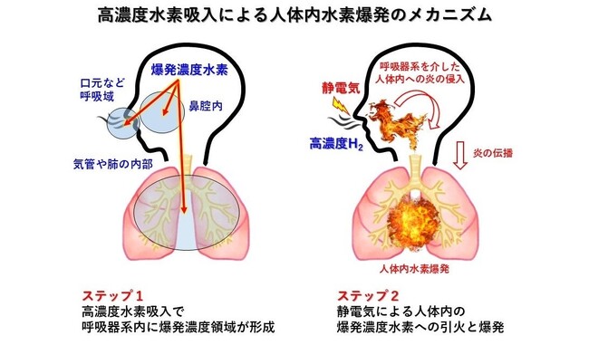 高濃度水素吸入器の着火実験と人体内水素爆発事故|MiZ・慶應義塾大学 共同研究