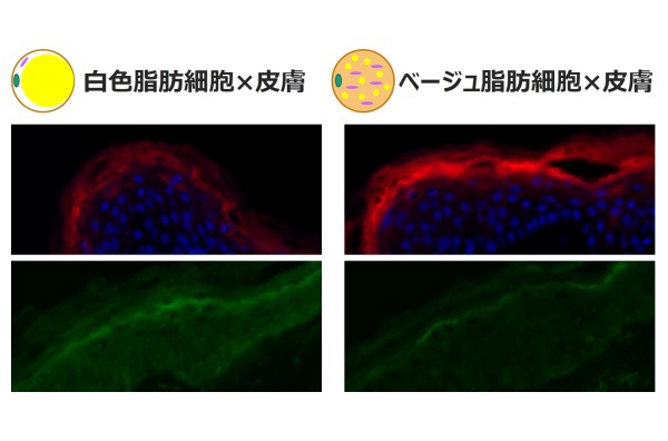 エネルギーを燃やす「ベージュ脂肪細胞」が肌のバリア機能を高めることを発見