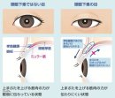 眼瞼下垂とは 眼瞼下垂とは