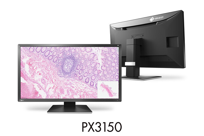 EIZO、デジタル化が進む病理分野に向け、初の病理専用モニターを発売