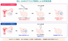 若年女性がん患者の卵巣機能を守るために～卵巣保護目的のGnRHアナログ製剤、普及への課題が明らかに～