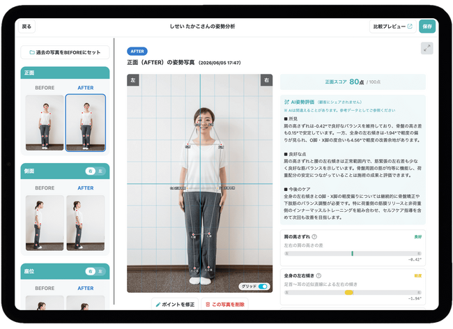 【現場と共創した「AI姿勢分析」】整骨院・鍼灸院向け電子カルテ『カルッテ』が、施術の価値を