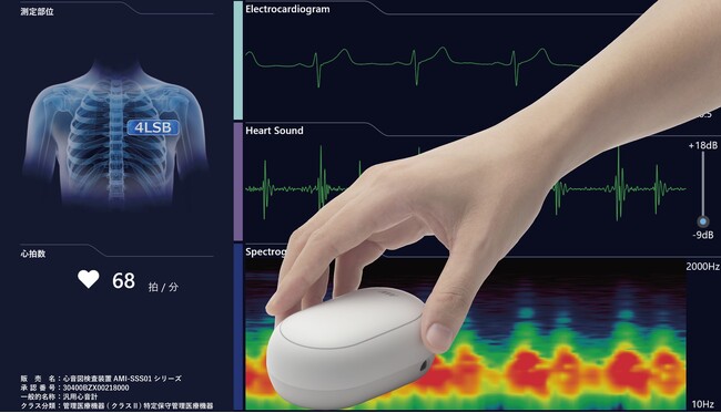 AIで心疾患のリスクを可視化する「超聴診器」を開発するAMI株式会社、一般社団法人自治体DX推進協議会（GDX）に入会。自治体向け「地域の心臓検診に関するアンケート調査」を実施