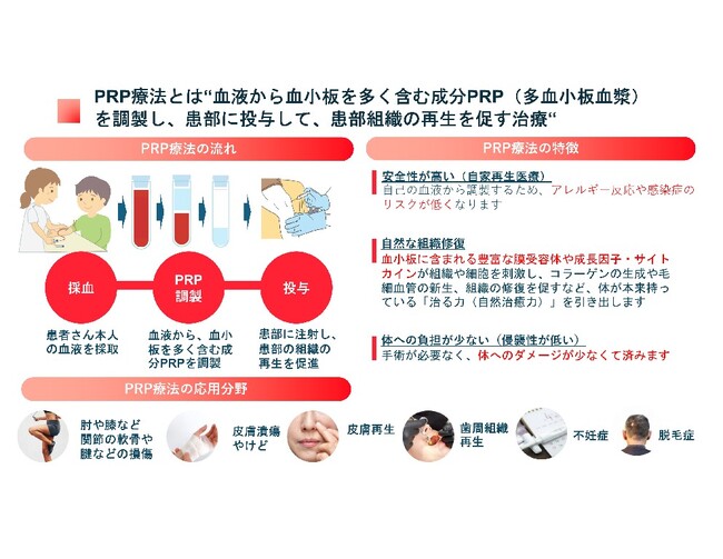 PRP事業におけるコージンバイオとAdipoSeedsの業務提携の実施について