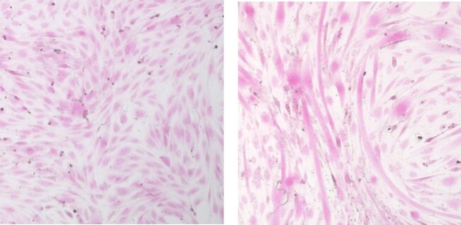 セイタカミロバラン果実に表情筋ケア効果を発見