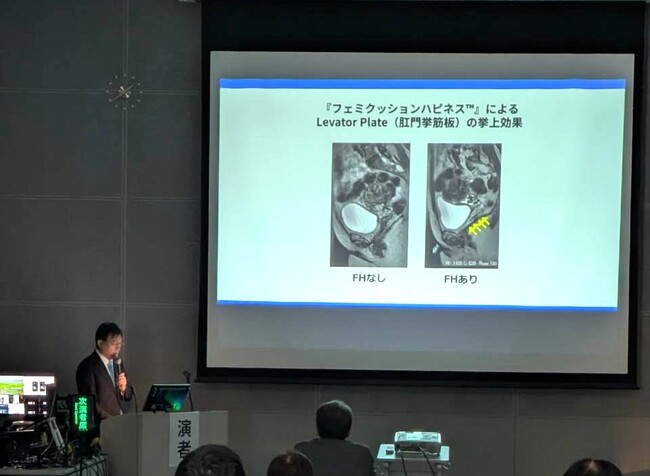 永尾光一医師、「フェミクッションハピネス(TM)」装着による骨盤底支持構造の変化を学会発表