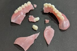 犬に噛まれてズタボロの義歯 犬に噛まれてズタボロの義歯