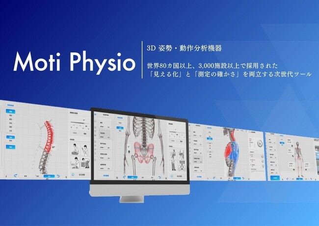 横須賀発、治療院の「見える化」を全国へ　世界80カ国の3D姿勢分析機器、日本総代理店として本格展開