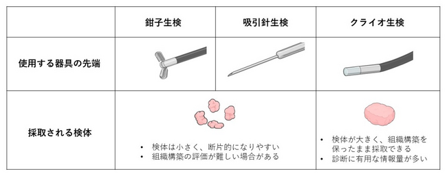 従来の生検法では診断が難しい肺の末梢病変に対するクライオ生検の有効性を国際共同試験で証明　高品質で十分な組織量の確保により肺がんのゲノム医療への貢献が期待