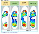 足圧分散図 足圧分散図
