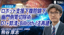 ロボット支援下腹腔鏡下幽門側胃切除術 D1+郭清 Billroth-I法再建 ロボット支援下腹腔鏡下幽門側胃切除術 D1+郭清 Billroth-I法再建