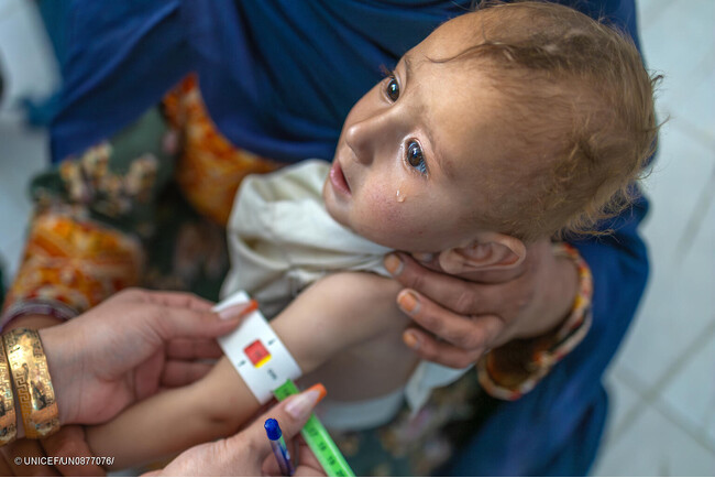 アフガニスタンで急性栄養不良が急増　緊急治療を必要とする子ども　2027年には過去最多の400万人超に　ユニセフらの最新分析が警鐘 【プレスリリース】